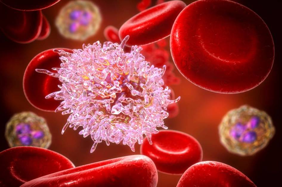 هل سرطان الدم مميت؟